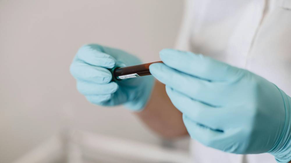 разжижение крови