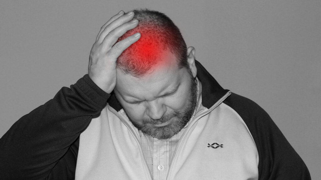 лечение кластерной головной боли