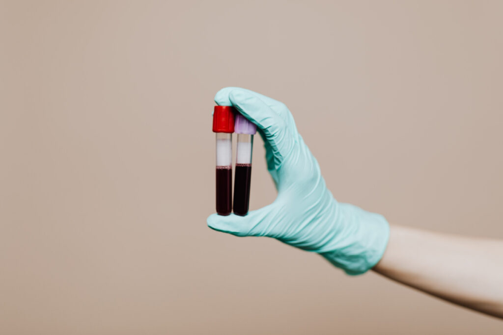 cиндром раздраженного кишечника симптомы