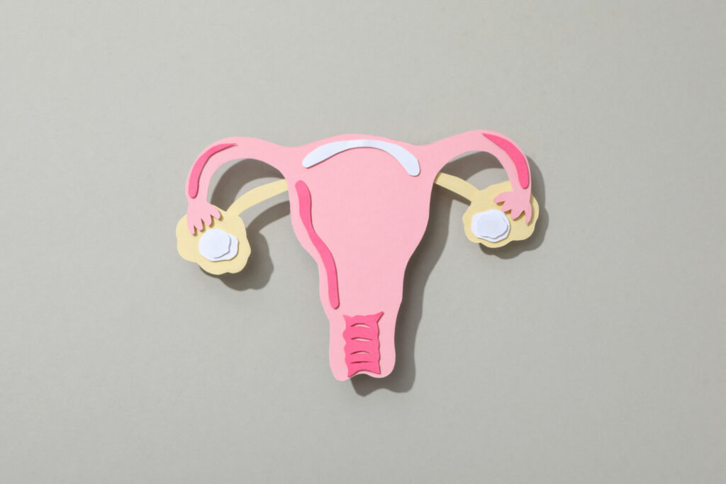 Что такое миома матки